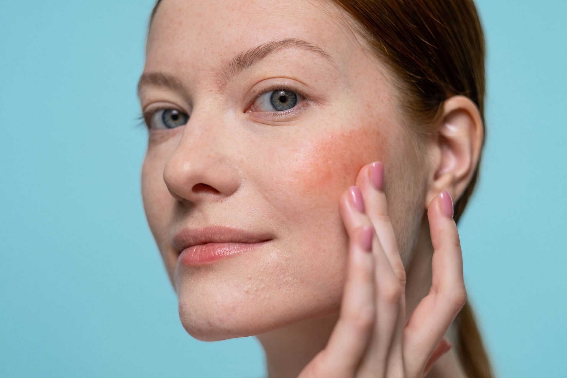 A niacin flush is not dangerous and lasts only a few minutes (Image via Pexels/Ron lach)